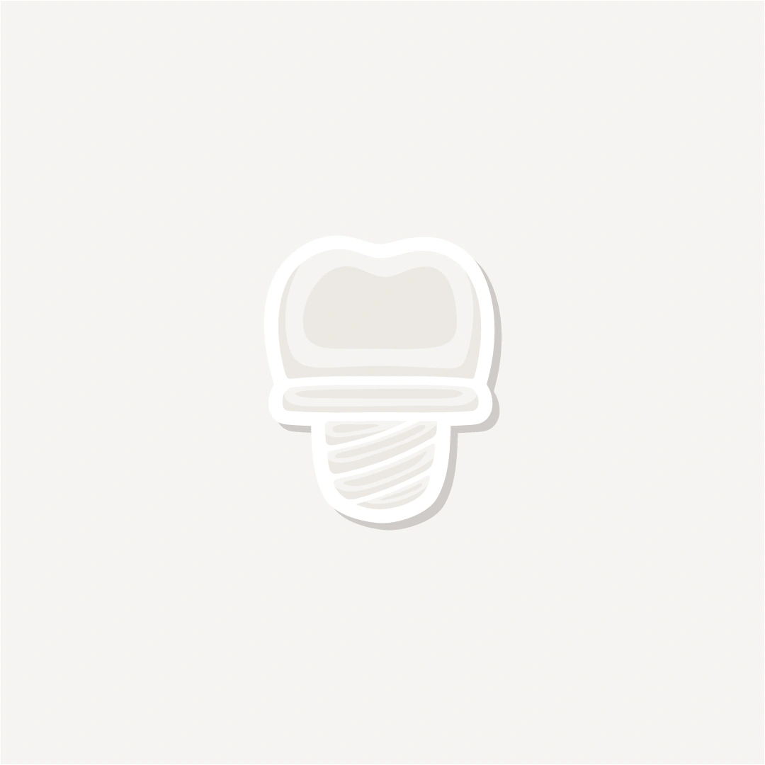 Implante e Cirurgia